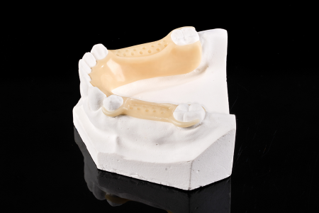 Partial Denture