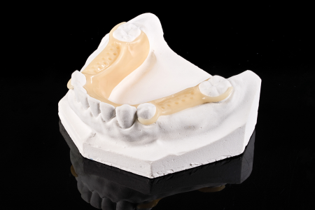 Partial Denture