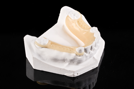 Partial Denture