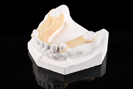 Partial Denture