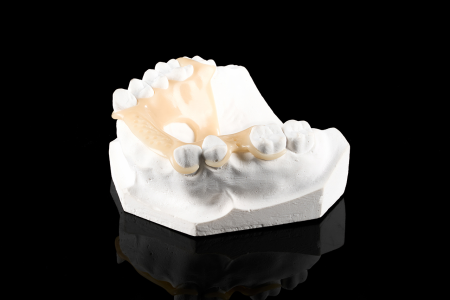 Partial Denture