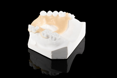 Partial Denture