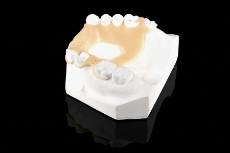 Partial Denture