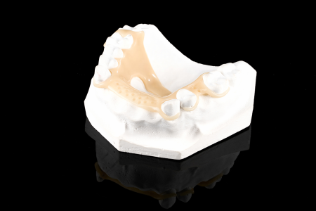 Partial Denture