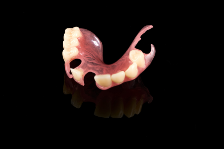 Partial Denture
