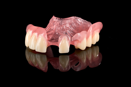 Partial Denture