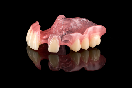 Partial Denture