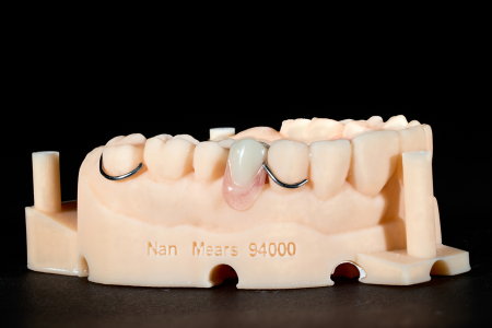 Partial Denture