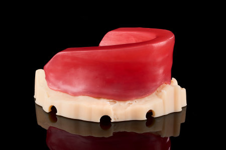 Partial Denture