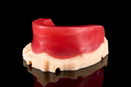 Partial Denture