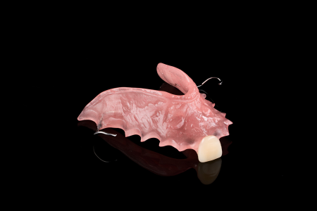 Partial Denture
