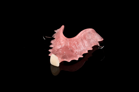 Partial Denture