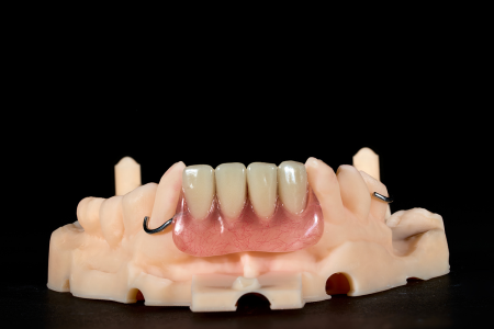 Partial Denture