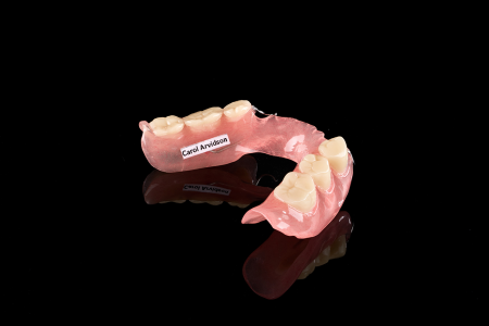 Partial Denture