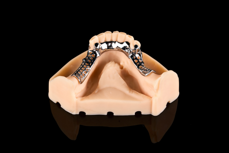 Partial Denture