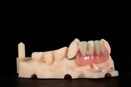 Partial Denture