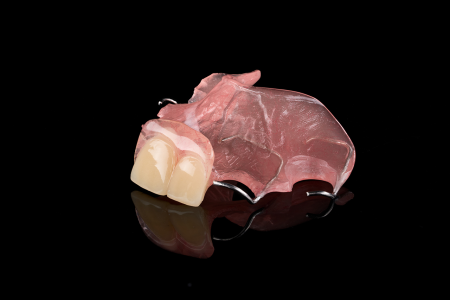 Partial Denture