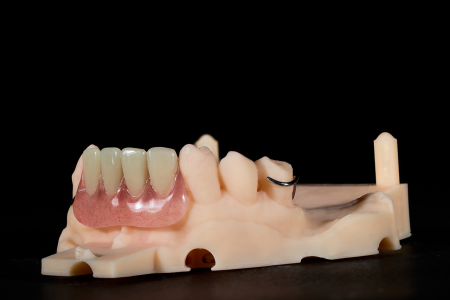 Partial Denture