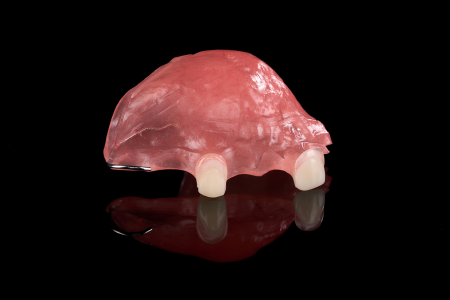 Partial Denture