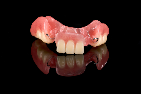 Partial Denture
