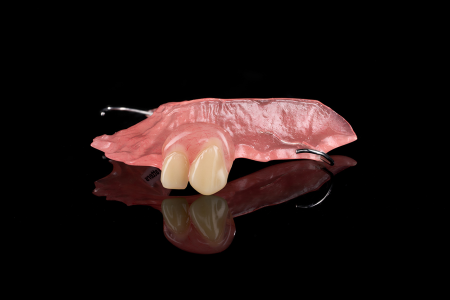 Partial Denture