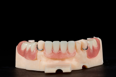 Partial Denture