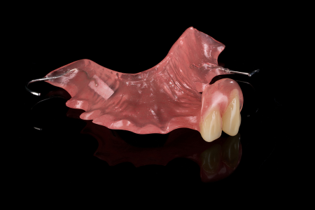 Partial Denture