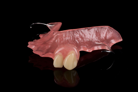 Partial Denture