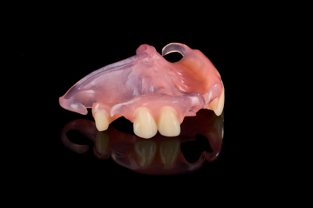 Partial Denture