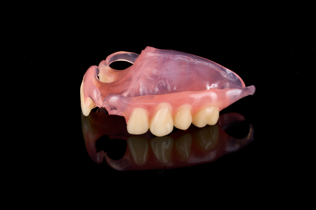 Partial Denture