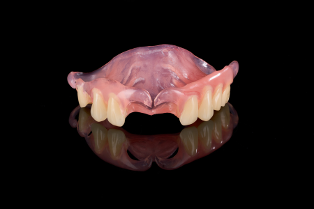 Partial Denture