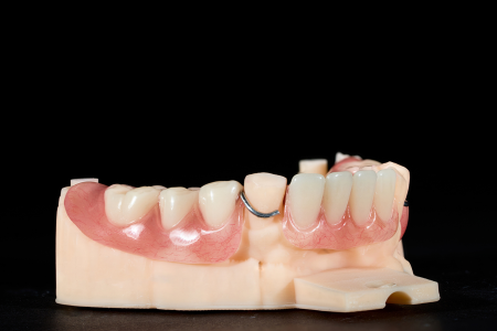 Partial Denture