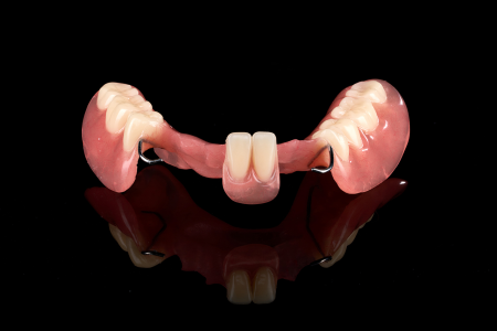 Partial Denture