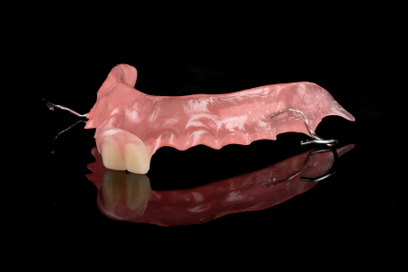 Partial Denture