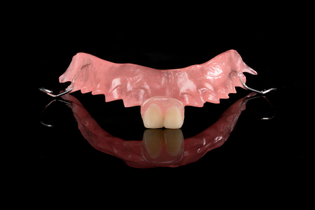 Partial Denture