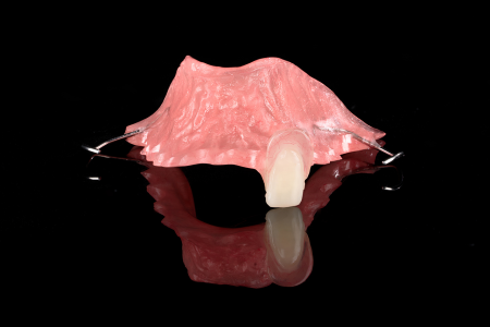 Partial Denture