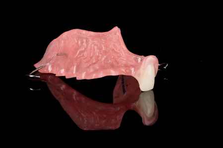 Partial Denture