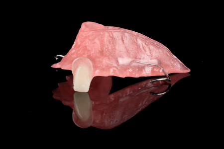 Partial Denture