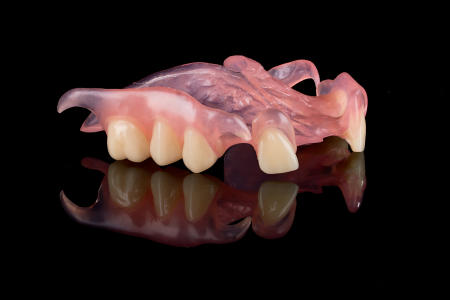 Partial Denture