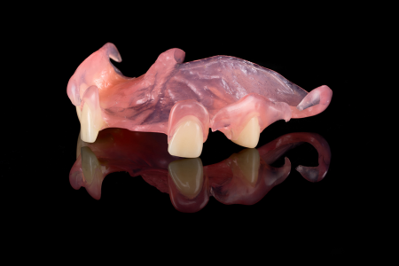 Partial Denture
