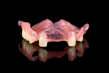 Partial Denture