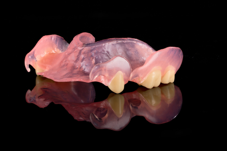 Partial Denture