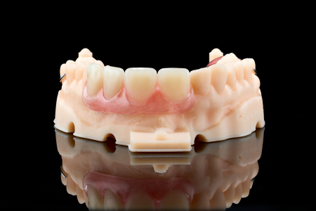 Partial Denture