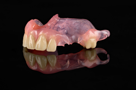 Partial Denture