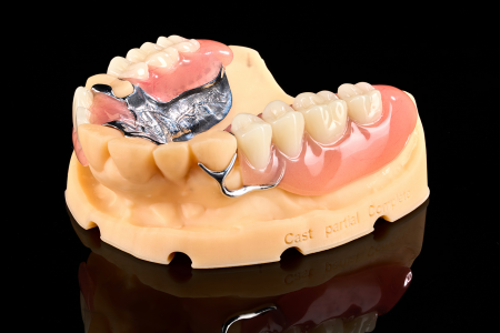 Partial Denture
