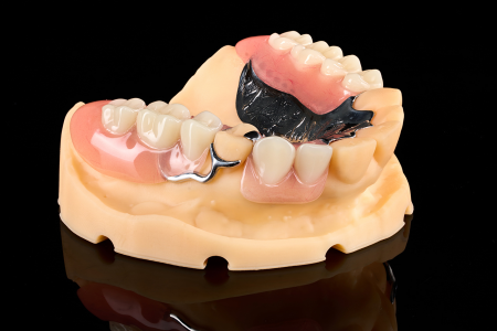 Partial Denture