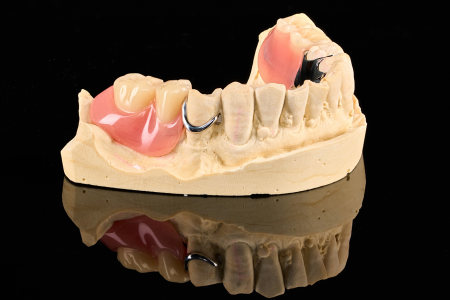Partial Denture