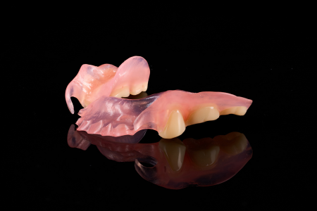 Partial Denture