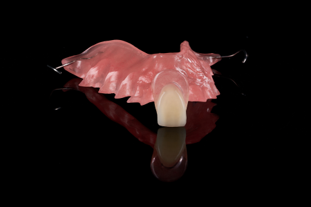 Partial Denture