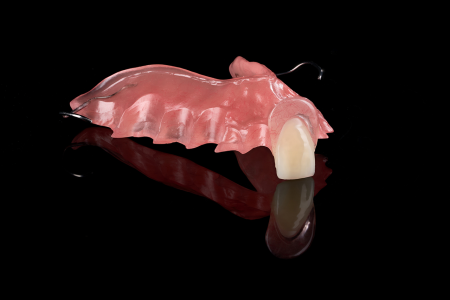 Partial Denture